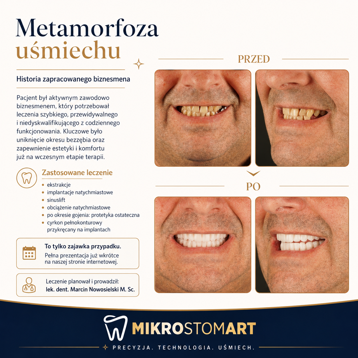 Metamorfoza uśmiechu — przed i po, kompleksowa odbudowa, Mikrostomart Opole
